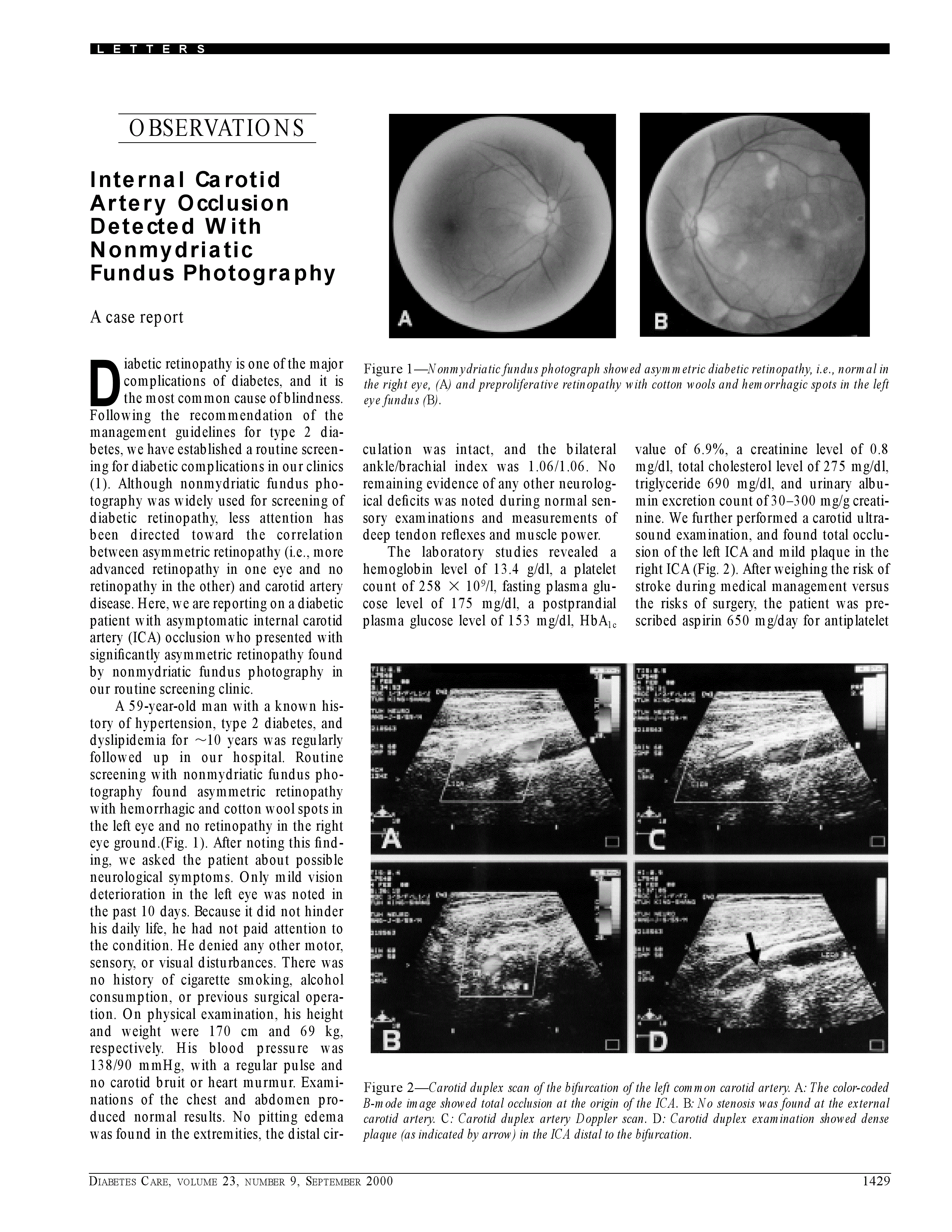 First page of Internal carotid artery occlusion detected with nonmydriatic fundus photography: a case report.