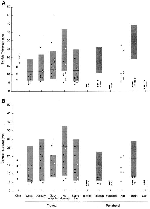 Figure 1—. Skinfold thickness at various anatomic sites in women (A) and men (B) with FPLD. ○, patients with diabetes; •, patients without diabetes. The shaded bars represent the median and 10th and 90th percentile values of skinfold thickness for normal women aged 18–55 years in A (13) and for normal men aged 18 to 61 years in B (14). Women with diabetes had more fat accumulation at the chin and biceps than those without diabetes (P < 0.05).