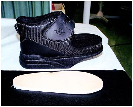 Figure 1—. Temporary shoe.