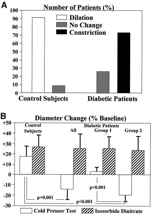 Figure 1—. A: Types of responses of left anterior descending coronary artery to the CPT in the study population. B: Diameter changes in each group of patients in response to the CPT and intracoronary isosorbide dinitrate.