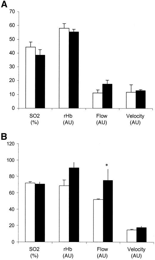 Figure 2—. O2C measurement on healthy skin at the forefoot of healthy volunteers (□; n = 20) and diabetic patients (▪; n = 14). A: Measurements were performed at 2 mm depth. B: Measurements were performed at 6 mm depth. P < 0.05 was considered significant.