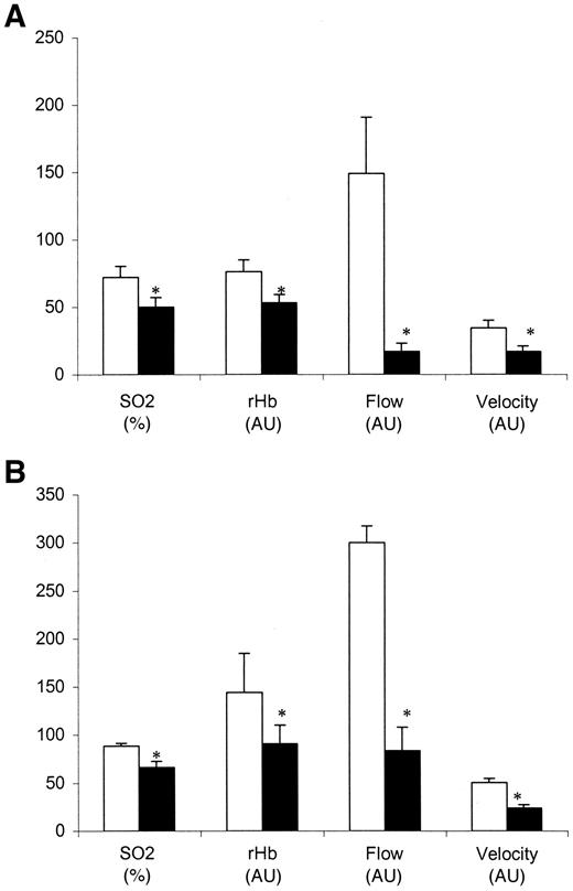 Figure 4—. O2C measurement at the wound site. Wounds were classified as healing (□; n = 6) or nonhealing (▪; n = 8). A: Measurement was performed at 2 mm depth. B: Measurement was performed at 6 mm depth. P < 0.05 was considered significant.
