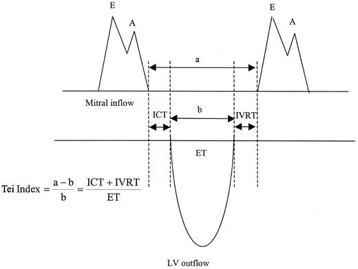 Figure 1—. Diagram of mitral inflow pattern, aortic outflow pattern, isovolumic time intervals, and Tei index.
