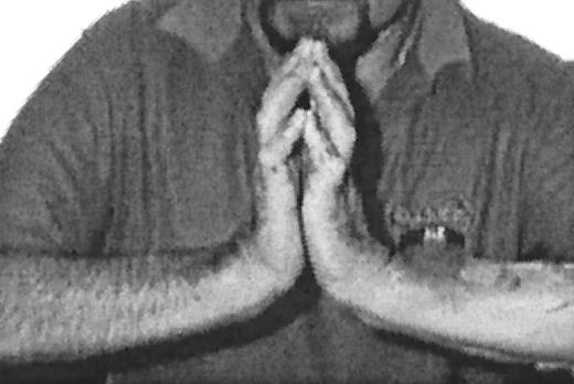 Figure 2—. The “prayer sign” caused by the failure of opposition of the palmer surfaces of the hands due to joint limitation, is a useful clinical sign for identification of patients with limited joint mobility. (Reproduced by permission of BMJ publishing. From Smith LL, Burnet SP, McNeil JD. Br J Sports Med 37:30–35, 2003. Copyright 2003 BMJ publishing.)
