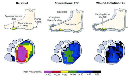 Figure 1—. Schematic representation of the casting methods shown with representative pressure distributions from subject 8.