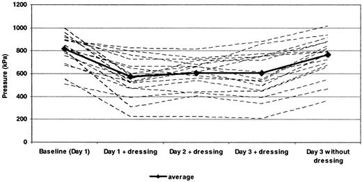 Figure 1—. Peak plantar pressures of all participants walking barefoot without (baseline and day 3 without PRD) and with (days 1, 2, and 3) the prototype PRD.