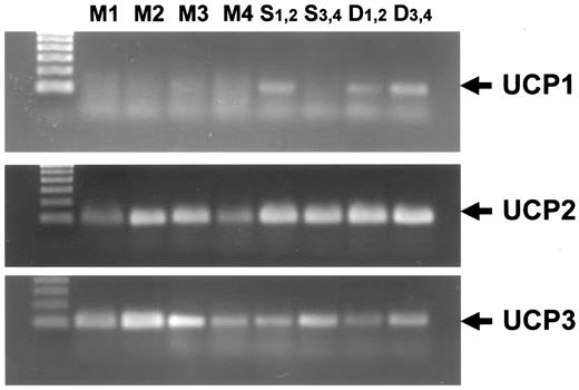 Figure 1—. Elution patterns of UCP1, UCP2, and UCP3 mRNA amplified by RT-PCR. Four male Long-Evans Tokushima Otsuka rats were used. M1–M4 indicate muscle samples from four animals. S1,2, S3,4 and D1,2, D3,4 indicate the spinal cord and DRG samples, respectively; because of the small sizes of these organs, tissue samples from two animals were combined and analyzed. UCP1 mRNA was weakly detected in one spinal cord and two DRG samples. UCP2 mRNA was clearly detected in both spinal cord and DRG samples, as well as in two muscle samples. UCP3 mRNA was detected in muscle, spinal cord, and DRG.