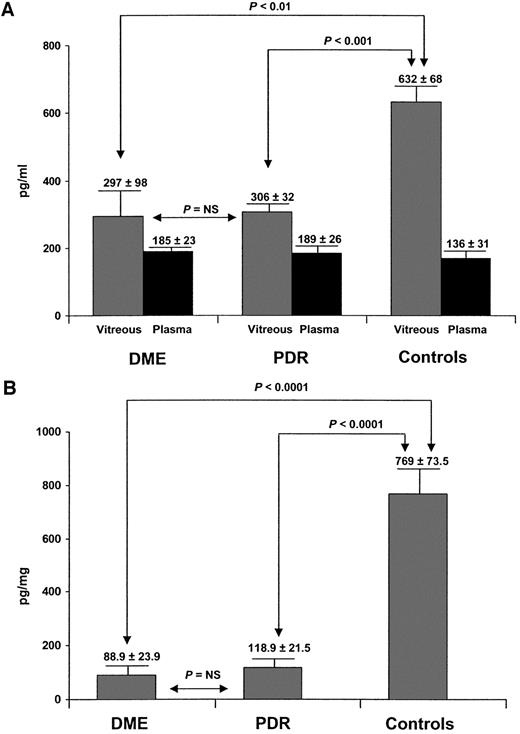 Figure 1—. A: Intravitreous and plasma concentrations of SST-28 (pg/ml) in patients with DME or PDR and in nondiabetic control subjects. B: Ratio of intravitreal SST-28 concentration to total intravitreal proteins (pg/mg). Values are expressed as the mean ± SEM.