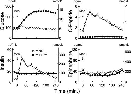 Figure 1. Means ± SEM plasma glucose, C-peptide, insulin, and epinephrine concentrations before and after ingestion of a mixed meal in basal insulin–infused patients with type 1 diabetes (T1DM) (●) and nondiabetic (ND) individuals (○). Differences in glucose, C-peptide, and insulin levels, P < 0.0001.