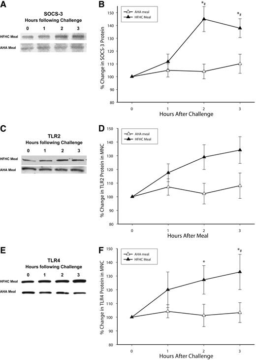 Figure 1. SOCS-3 (A and B), TLR2 (C and D), and TLR4 (E and F) protein levels by Western blotting after an HFHC or AHA meal challenge in normal healthy subjects (n = 10 each). A: Representative SOCS-3 immunoblot in total cell lysate from MNCs. B: SOCS-3 protein densitometry (n = 10 each). C: Representative TLR2 immunoblot in total cell lysate from MNCs. D: TLR2 protein densitometry (n = 10 each). E: Representative TLR4 immunoblot in total cell lysate from MNCs. F: TLR4 protein densitometry (n = 10 each). *P < 0.05 by RMANOVA compared with baseline; #P < 0.05 by two-way RMANOVA comparing groups.