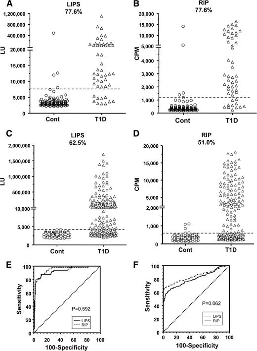 Figure 1. GAD65 autoantibodies as determined by LIPS (A) and RIP (B) and IA-2β autoantibodies as determined by LIPS (C) and RIP (D). Dotted lines represent 3 SDs above the mean of the nondiabetic control sera. E: ROC analysis showing the area under the curve for GAD autoantibodies by LIPS (0.929 [95% CI 0.875–0.964]) and by RIP (0.941 [0.891–0.973]). There was no statistical difference (P = 0.592). F: ROC analysis showing the area under the curve for IA-2β autoantibodies by LIPS (0.844 [0.804– 0.879]) and by RIP (0.807 [0.763–0.849]). There was no statistical difference (P = 0.062).