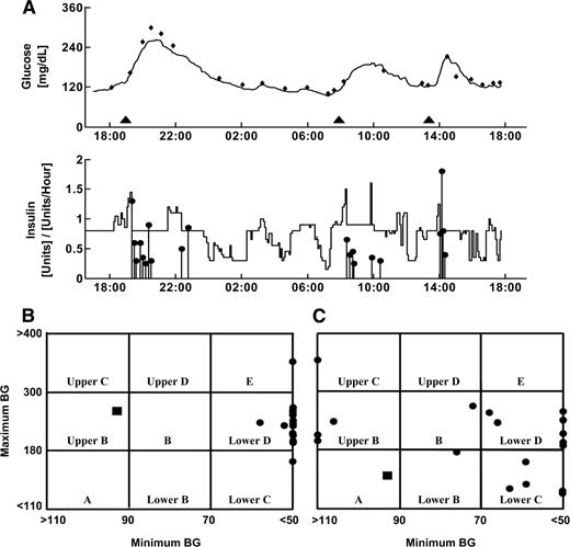 Figure 1. Example of 24-h closed-loop session results conducted with subject 1. A: Glucose trace and the insulin treatment during the 24-h closed-loop trial with subject 1. The top graph shows the CGS readings (black line), reference YSI measurements (♦), and the meal times (▴). The bottom graph shows the insulin treatment delivered by the MDLAP (horizontal line = basal rate, vertical lines with ● = insulin boluses). B: Control variability grid analysis over a time period of 24 h for subject 1. C: Control variability grid analysis overnight (0000–0800 h) for subject 1. The nine zones of the CVGA are associated with different qualities of glycemic regulation: A, accurate control; lower B, benign deviations into hypoglycemia; B, benign control deviations; upper B, benign deviations into hyperglycemia; lower C, overcorrection of hypoglycemia; upper C, overcorrection of hyperglycemia; lower D, failure to deal with hypoglycemia; upper D, failure to deal with hyperglycemia; and E, erroneous control. In both figures, the circles represent the minimum/maximum glucose level taken from the relevant time period glucose readings during home care and the rectangles indicate the levels during the MDLAP-regulated closed-loop session. BG, blood glucose.