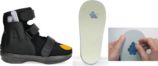 Figure 1. “Stabil-D” device and the “Modus” insole. (A high-quality digital representation of this figure is available in the online issue.)