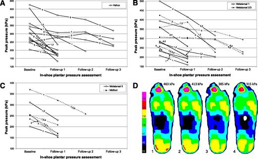 Figure 2. A–C: Line graphs showing, for each ROI per foot location, the change in peak pressure from baseline to follow-up in-shoe pressure measurement as a result of each round of footwear modification. Also shown for each ROI, as cross outs of the line graphs, are the modifications applied, where 1) denotes the local removal of material in the insole, 2) the local softening of material in the insole, 3) the replacement of the top cover of the insole, 4) the addition of a metatarsal or hallux pad or bar in the insole, and 5) an earlier or more significant rocker or roller in the shoe outsole or the insole. D: Peak pressure isobar diagrams showing the mean peak pressure measured over multiple steps in the right foot in a tested patient at baseline (1) and after three rounds of footwear modifications (2–4). This patient had limited mobility at the first metatarsal phalangeal joint and a history of ulceration at the plantar hallux. He wore fully customized therapeutic footwear. The hallux region was selected as an ROI for pressure optimization. Footwear modifications used (and their effect on mean peak pressure in kPa) were as follows: round 1: addition of a hallux bar just distal to the first metatarsal head in the insole (−50 kPa); round 2: application of an earlier roller in the shoe outsole (−28 kPa); and round 3: replacement of the top layer of the insole with 3-mm-thick ×2 silicone foam (−70 kPa). Total reduction in mean peak pressure at the hallux was 148 kPa or 32%. The diagrams show a typical pattern for the study finding that footwear modification did not lead to excessive buildup of peak pressure in neighboring regions, but rather to a peak pressure decrease across foot regions.