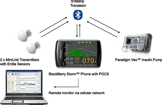 Figure 1. The components of the Medtronic PGCS.