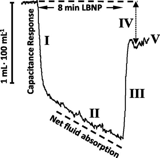 Figure 1. Original tracing illustrating tissue compensatory volume changes evoked by LBNP30. The initial rapid decrease in volume reflects the mobilization of regional blood from peripheral to central circulation (capacitance response), whereas the much slower, but continuous, decline reflects capillary fluid absorption. After the cessation of LBNP, there is a rapid return of blood volume. The remaining deficit reflects extravascular fluid absorbed during LBNP. See text for explanation of roman numerals.