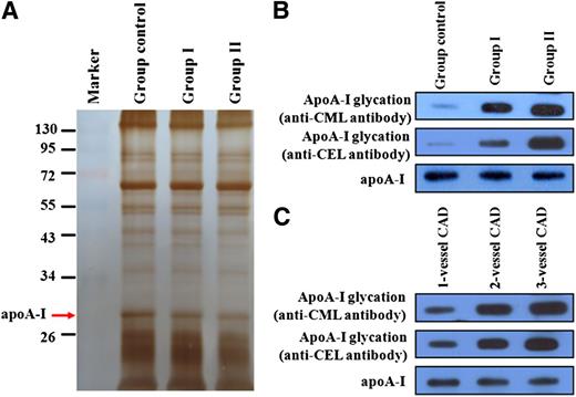 Figure 2. Detection of apoA-I glycation and apoA-I levels by Western blot.