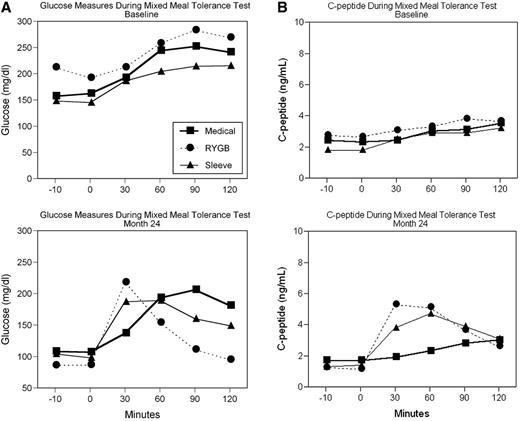 Figure 1. Glucose (A) and C-peptide (B) during the mixed-meal tolerance test performed at time of randomization (baseline) and at 24 months after randomization for IMT, sleeve gastrectomy, and gastric bypass. Mixed meal consisted of Boost (8 ounces) with 30-min interval blood sampling for glucose and C-peptide values. Data are shown in median values. RYGB, Roux-en-Y gastric bypass.