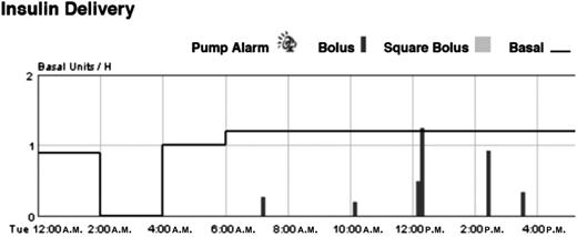 Figure 1. Verification of suspension through download of insulin pump. Downloading subjects’ pump data onto CareLink personal software ensures that basal insulin suspension occurred as specified and that no surreptitious insulin delivery occurred in the overnight period. In this graph, basal insulin delivery in units per hour is listed on the left y-axis, as noted by the horizontal lines, whereas bolus insulin delivery is noted by the vertical lines. Here suspension occurred between 2:00 and 4:00 a.m.