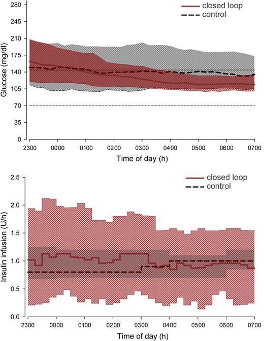 Figure 2. Sensor glucose (top panel) and insulin delivery (bottom panel) from 2300 to 0700 h. Median overnight profiles are represented by red solid (closed loop) and black dashed (control therapy) lines. The interquartile range is shown as red (closed loop) and gray (control therapy) regions. The plots demonstrate progressively tighter overnight glucose levels during closed-loop therapy brought about by more varying insulin delivery, the typical tradeoff of insulin delivery variability for glucose consistency. The target glucose range 70–144 mg/dL is denoted by short dashed lines in the top panel.