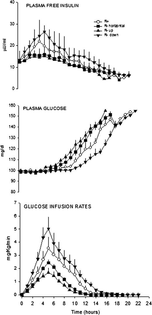 Figure 2. Plasma free insulin and glucose concentrations and GIRs to maintain euglycemia in the four studies after subcutaneous injection of 0.35 units/kg NPH insulin in 11 subjects with T1DM. In the R+ study, NPH insulin was properly resuspended before injection. In the R- horizontal, R- up, and R- down studies, NPH insulin was injected without prior resuspension (R- horizontal, pen maintained horizontally; R- up and R- down, pen maintained vertically with R- up tip up and R- down tip down).