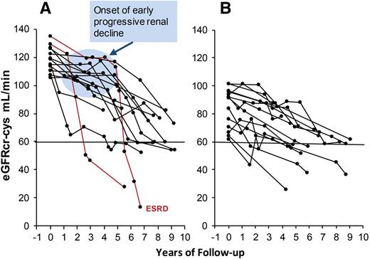 Figure 2. eGFRcr-cys trajectories in patients with T1D with NA and progressive renal decline (eGFRcr-cys loss ≥3.3%/year) during 4–10 years of follow-up. The trajectories are plotted according to median (105 mL/min/1.73 m2) baseline eGFRcr-cys. Panel A shows decliners with baseline eGFRcr-cys above median. Panel B shows decliners below median. Lines in red indicate patients who developed proteinuria after onset of early renal decline. Half of the decliners in both panels had MA at the end of the follow-up. Figure adapted with permission from Krolewski et al. (19).