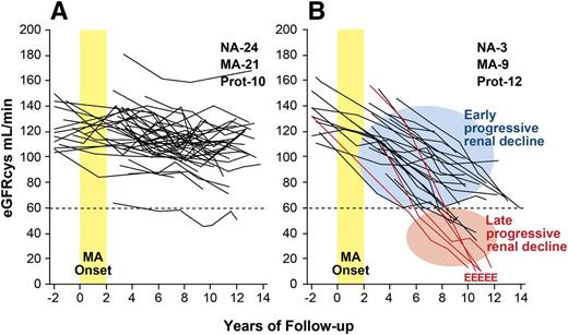 Figure 3. Trajectories of eGFRcys in patients with T1D and new-onset MA who were followed for 12 years. A: Patients with stable renal function (nondecliners). The eGFRcys slopes of these patients reflect a loss of <3.3%/year. B: Patients with early progressive renal decline (decliners). The eGFRcys slopes of these patients reflect a loss ≥3.3%/year. MA onset indicates the 2-year interval when multiple determinations of ACR became elevated; E indicates the date of ESRD diagnosis. Insets: The numbers of patients at the end of follow-up according to category of albumin excretion rate: NA, MA, and proteinuria (Prot). Figure adapted with permission from Merchant et al. (25) and supplemented with unpublished data of patients who developed ESRD (A.S.K., unpublished data).