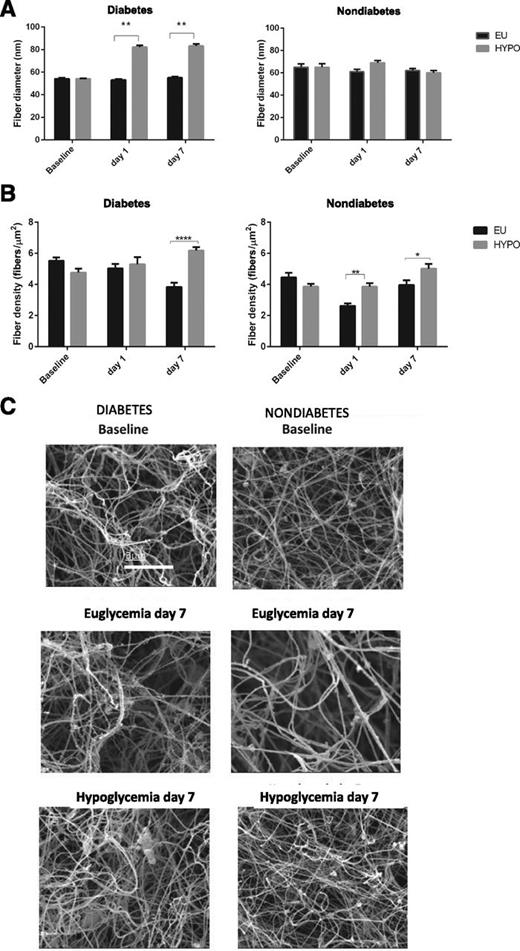 Figure 3. Fibrin network properties and scanning electron micrographs of fibrin clots after euglycemia vs. hypoglycemia in participants with and without diabetes. Fiber network density (A) and fibrin fiber thickness (B) after euglycemia vs. hypoglycemia. Fiber thickness was measured for a total number of 160 fibers (40 fibers measured from four different clot areas at each time point). Data are mean ± SE. C: Visualization of ex vivo fibrin clots from pooled plasma samples in participants with (n = 10) and without (n = 10) diabetes. A decrease is seen in the fiber network after euglycemia in both groups as opposed to an increase in the network density after hypoglycemia at day 7. *P < 0.01, **P < 0.01, ****P < 0.0001 euglycemia vs. hypoglycemia. EU, euglycemic; HYPO, hypoglycemic.