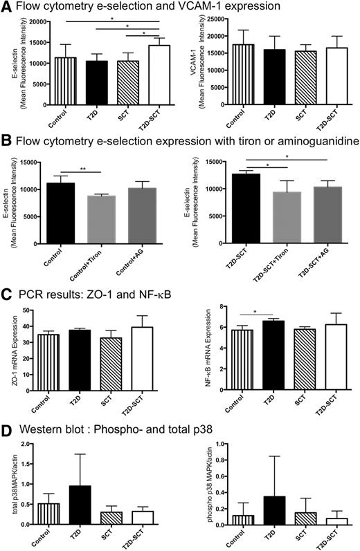 Figure 2. Flow cytometry, real-time quantitative PCR, and Western blot results for subjects with T2D and SCT (T2D-SCT) or without SCT (T2D) and subjects without T2D with SCT (SCT) or without SCT (Control). A: Flow cytometry results for E-selectin and VCAM-1 expression in HAECs incubated with TNF-α and plasma from subjects; *P < 0.05. B: Flow cytometry results for E-selectin expression in HAECs incubated with TNF-α and either control or T2D-SCT plasma (Control or T2D-SCT, respectively), control or T2D-SCT plasma and the antioxidant tiron (Control+Tiron or T2D-SCT+Tiron), and control or T2D-SCT plasma with the AGE inhibitor aminoguanidine hydrochloride (Control+AG or T2D-SCT+AG); *P < 0.05, **P < 0.01. C: Real-time quantitative PCR for results showing relative mRNA expression of NF-κB and ZO-1 in HAECs incubated with TNF-α and plasma from subjects, *P < 0.05. D: Western blot results showing the relative expression of phospho- and total p38 MAPK in HAECs incubated with TNF-α and plasma from subjects. Results are presented as the mean ± SD.