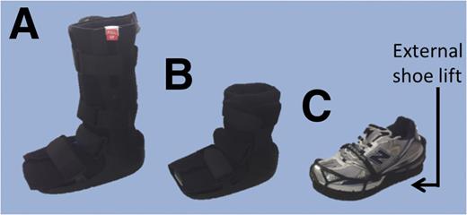 Figure 1. Offloading footwear: the knee-high RCW (A), the ankle-high RCW (B), and the standardized shoe with an external shoe lift attached (C).