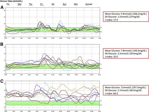 Figure 2. Examples of CGM traces carried out between 24 and 28 weeks of gestation in women with type 1 diabetes in pregnancy (27). A: Low mean glucose with low GV. B: Moderate mean glucose with moderate GV. C: High mean glucose with high GV. GV indicated by SD of glucose and J-index.