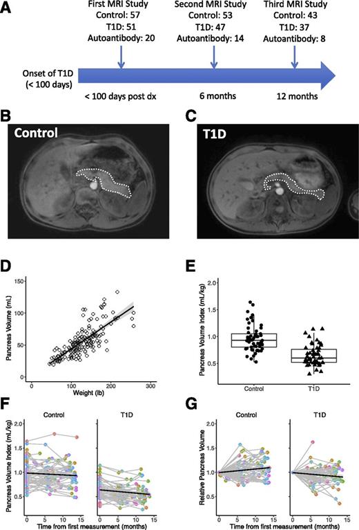 Figure 1. A: Schematic of study design. MRI was performed on participants with T1D within 100 days of diagnosis (dx) and repeated at 6-month increments. Participants with autoantibodies or without T1D were scanned at similar intervals. The number of individuals imaged at the 6- and 12-month time points is shown. B: An axial MRI slice through the abdomen of a control participant shows the pancreas (outlined in white). Participant was a 10-year-old male who weighed 29 kg. C: An axial MRI slice through the abdomen of a participant with recent-onset T1D shows a smaller, thinner pancreas than seen in the control participant (outlined in white). Participant was also a 10-year-old male who weighed 29 kg. D: In the control cohort, pancreas volume correlated with participant weight over the course of adolescent growth. E: Pancreas volume normalized by participant weight, yielding a pancreas volume index in units of mL/kg, is smaller in participants with T1D than control participants. F: Pancreas volume index is unchanged in the control pancreas over a 1-year period but declines in participants with T1D over the year after diagnosis. G: When normalized to the baseline measurement for each study participant, pancreas volume increases in the control population but declines in participants with T1D. Shading indicates the 95% CI in all figures.