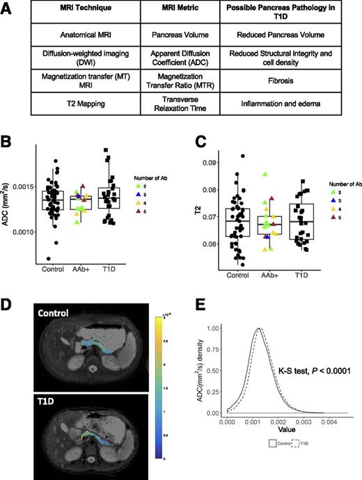 Figure 3. A: MRI techniques performed in this study, corresponding quantitative MRI metric, and possible pancreas pathologies in T1D that may be assayed by each technique. B: DW-MRI indicates that the mean ADC in the pancreas is higher in participants with recent-onset T1D. Autoantibody-positive (AAb+) participants are color coded according to the number of autoantibodies present at the time of the MRI scan. C: The mean T2 of the pancreas is similar in control participants, participants with T1D, and autoantibody-positive participants. D: Multiparametric maps of the ADC in the pancreas of a control participant (top) and participant with recent-onset T1D (bottom) reveal focal variations in ADC. The participants shown in D are both 10-year-old females; the control participant weighed 35 kg, and the participant with T1D weighed 36 kg. Note the difference in pancreas area between the participants and the focal area with high ADC in the head of the pancreas of the participant with T1D. E: Histogram analysis comparing the ADC of all voxels from control pancreata with the ADC of voxels from all T1D pancreata demonstrates differences in the distribution of ADC values, with higher numbers of voxels with high ADC in the T1D pancreas. Ab, antibody; K-S test, Kolmogorov-Smirnov test.