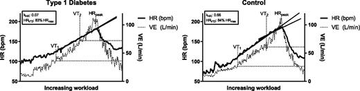 Figure 2. Schematic presentation of the calculation of the degree and direction of the HR-to-performance curve (kHR) for individuals with type 1 diabetes and control participants without type 1 diabetes.