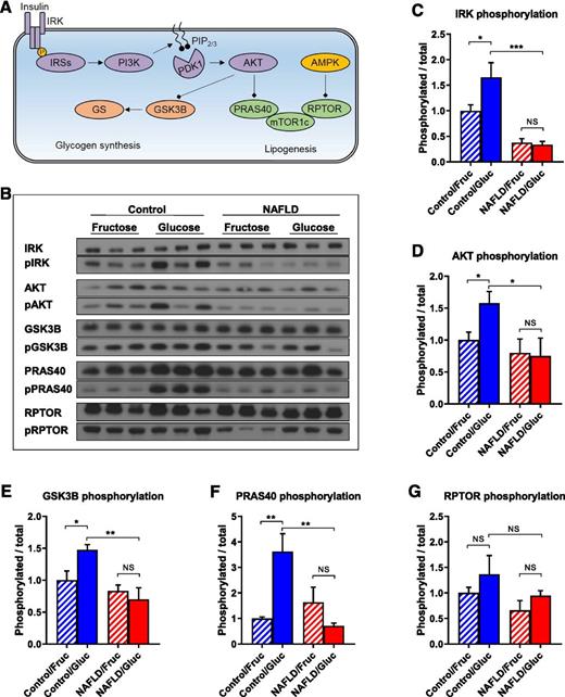 Figure 2. Insulin signaling in both glucose metabolism and lipogenesis pathways is attenuated in subjects with NAFLD. Schematic (A) and representative immunoblots (B) of insulin signaling in the glucose metabolism and lipogenesis pathways. Proximal insulin signaling, as reflected by IRK (C) and AKT (D) phosphorylation, is suppressed in subjects with NAFLD. Downstream insulin signaling in the glucose metabolism pathway (E), as reflected by GSK3B phosphorylation, is suppressed in subjects with NAFLD. Insulin-mediated regulation of mTORC1 (F), as reflected by PRAS40 phosphorylation, is suppressed in subjects with NAFLD. Insulin-independent/AMPK-mediated regulation of mTORC1 (G), as reflected by RPTOR phosphorylation, is unaltered in subjects with NAFLD. Data are mean ± SEM (n = 6 per group). *P < 0.05, **P < 0.01, ***P < 0.001 by t test. Fruc, fructose; Gluc, glucose.