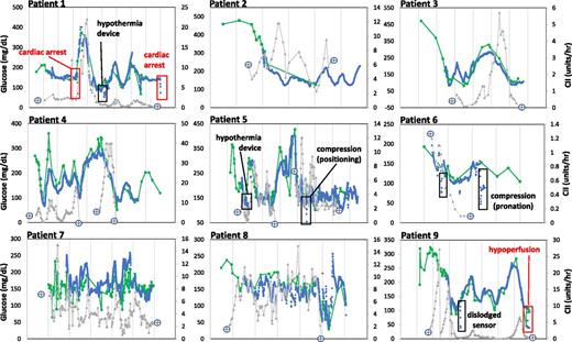 Figure 1. POC (Nova StatStrip glucose meter), real-time CGM (Dexcom G6), and hourly insulin requirements in critically ill patients treated with a computerized CII algorithm (Glucommander). Labeled boxes show identified interferences.