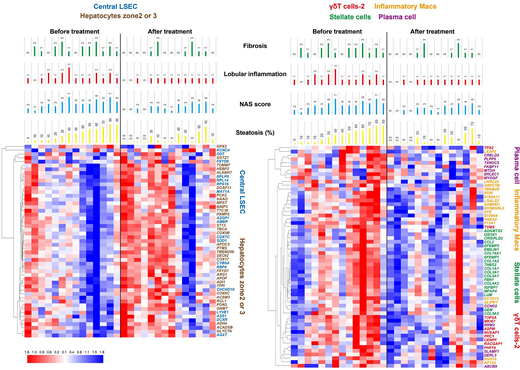 Heat maps of gene set enrichment analyses using gene sets of resident cells in the liver defined by single-cell RNA-seq analyses and corresponding liver histological scores before and after the tofogliflozin treatment. The heat maps show one-way hierarchical clustering of 51 representative genes involved in central LSECs and zone 2 and 3 hepatocytes (left) and 59 genes involved in γδT cells, inflammatory macrophages (macs), stellate cells, and plasma cells (right). Histological scores of fibrosis, lobular inflammation, NAS, and steatosis (%) are shown in individual patients before and after treatment, respectively. Gene expression patterns were well correlated with histological changes. The 51 genes involved in LSECs and zone 2 and 3 hepatocytes were coordinately downregulated in the liver with severe steatosis before treatment (left side of left panel). Tofogliflozin upregulated these genes expression (right side of left panel). The 59 genes, representative of γδT cells, inflammatory macrophages, stellate cells, and plasma cells, showed a similar gene expression pattern and clustered in each cell component. These genes were coordinately upregulated in the liver with severe steatosis before treatment (left side of right panel). Tofogliflozin downregulated these genes expression (right side of left panel).