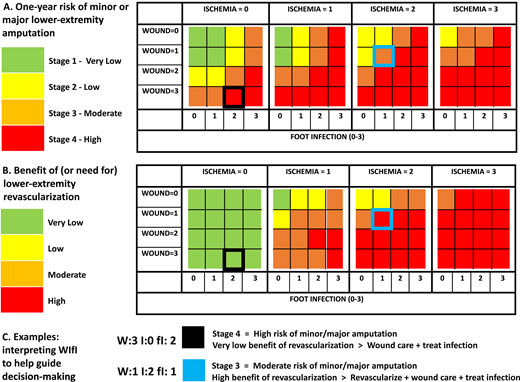 Society for Vascular Surgery WIfI classification, amputation risk stratification, and benefit of revascularization. Adapted from Mills et al. (21).