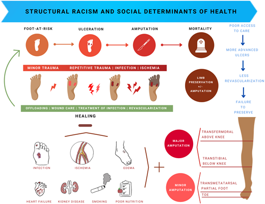 Pathways to ulceration and lower-extremity amputation in DFU.