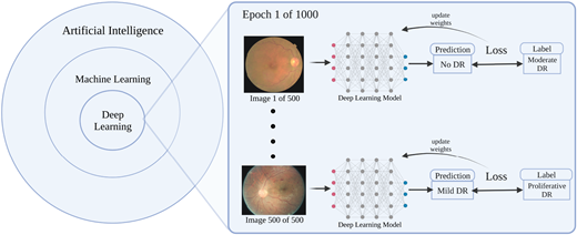 Artificial Intelligence and Diabetic Retinopathy: AI Framework ...
