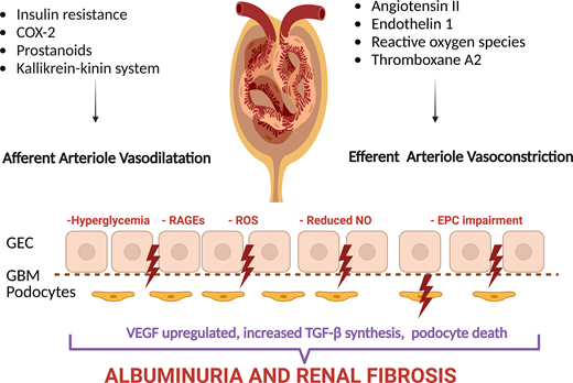 Local mechanisms underlying glomerular hypertension. Endothelin 1, reactive oxygen species, and thromboxane A2 increase efferent vessel tone, whereas insulin resistance upregulates cyclooxygenase 2 (COX-2), prostanoids, and the kallikrein-kinin system, resulting in afferent arteriole dilatation (138). RAS activation damages glomerular endothelial cells (GEC), which increases fenestrations and induces apoptosis. Hyperglycemia leads to advanced glycation end products (AGEs), which bind to their receptors (RAGEs), which decreases nitric oxide (NO) availability and stimulates transforming growth factor-β (TGF-β), a profibrotic factor. Diabetes further accelerates endothelial progenitor cell (EPC) aging, which reduces their reparative function. Vascular endothelial growth factor (VEGF) synthesis by podocytes is dysregulated. Podocyte injury leads to foot process effacement and podocyte loss, the unifying mechanism underlying albuminuria in diabetes (33–37).