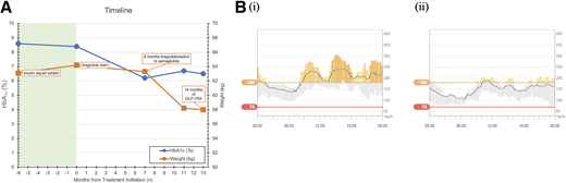 HbA1c and weight changes and CGM profiles for a young adult with permanent neonatal diabetes. A: HbA1c and weight changes following GLP-1RA introduction. B: CGM profiles for 14 days prior to (i) and after (ii) GLP-1RA introduction.