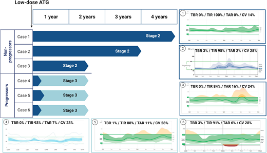 Progression versus nonprogression and CGM metrics in stage 2 ATG recipients. Blue bars demonstrate duration of delay as well as total duration of follow-up (upper left). Notably, all three progressors transitioned to stage 3 within 1–2 months posttreatment. CGM tracings for each subject are shown over a 2-week period at their final documented visit to date, indicating high TIR, low time below range (TBR), low time above range (TAR), and low coefficient of variation (CV) in both nonprogressors (cases 1–3, right) and progressors (cases 4–6, lower).