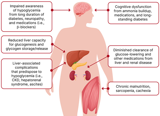 Impaired awareness of hypoglycemia from risk factors in cirrhosis. CKD, chronic kidney disease. Adapted with permission from Castera and Cusi (19).
