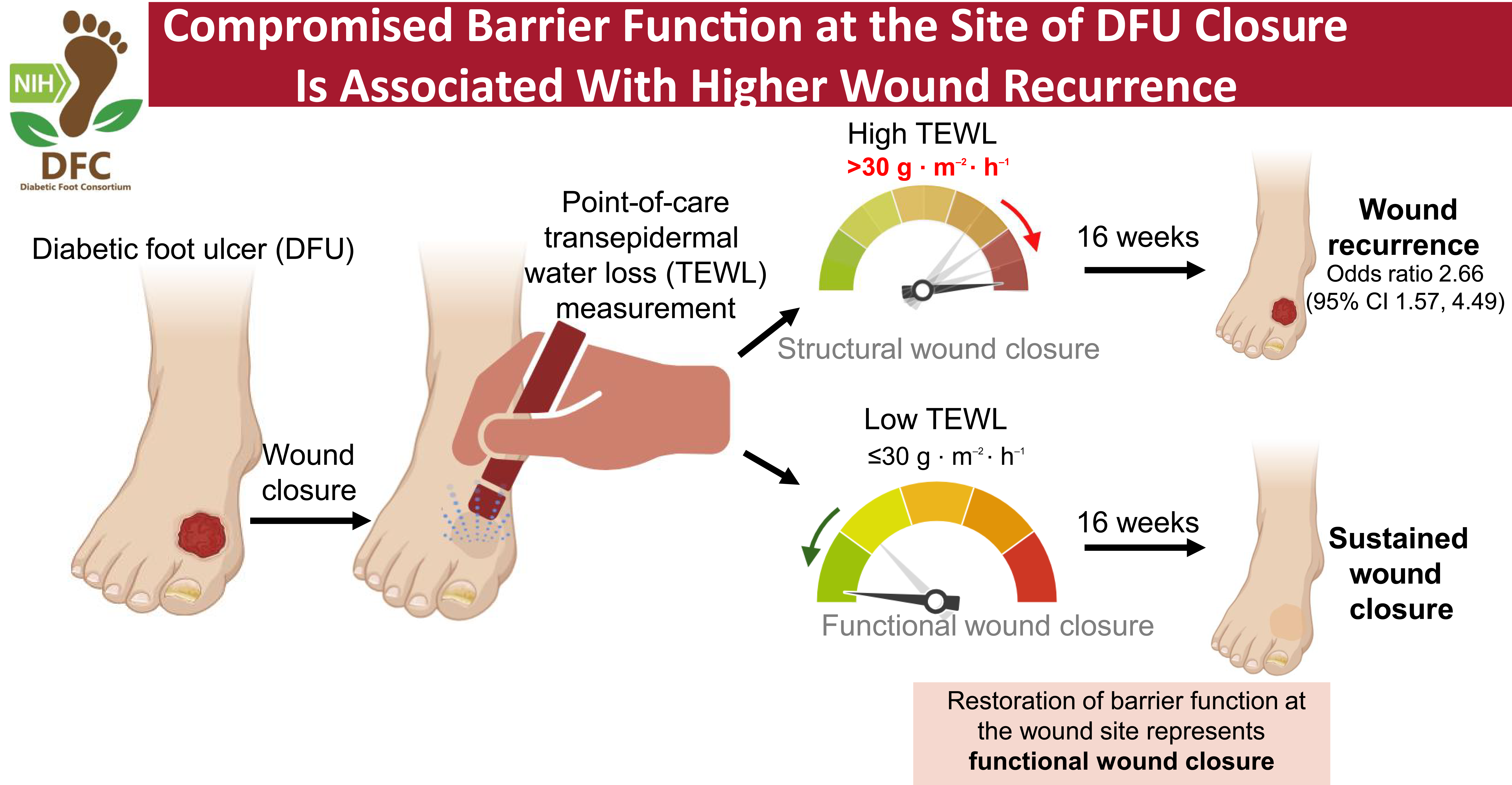 糖尿病性足潰瘍再発リスクの診断補助法を特定(Scientists identify diagnostic aid to determine risk of diabetic foot ulcer recurrence) 糖尿病性足潰瘍再発リスクの診断補助法を特定(Scientists identify diagnostic aid to determine risk of diabetic foot ulcer recurrence)