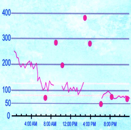 Case Study A 62YearOld Man With “Brittle” Type 1 Diabetes Clinical Diabetes American