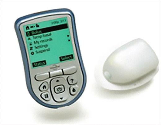 Figure 13. Omnipod