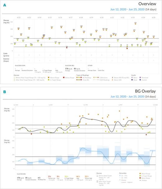 The Glucology MacroView device sitting on a glass office desk next to a laptop, showing a high-definition color-coded glucose