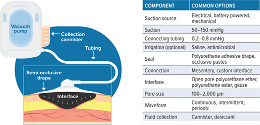 New Evidence-Based Therapies for Complex Diabetic Foot Wounds ...