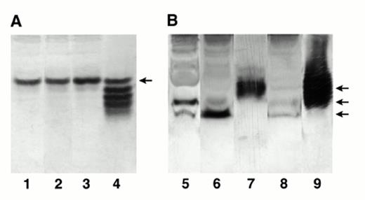 FIG. 1. Phosphorylation status of IGFBP-1 in transgenic mouse sera. Samples of 1 μl human (A) and rat IGFBP-1 (B) transgenic mouse sera were analyzed by nondenaturing PAGE and immunoblotting using an IGFBP-1 antiserum that recognizes both rat and human IGFBP-1 (15,21). Lanes 1-3 show individual serum samples from the human IGFBP-1 transgenic mice. Lane 4 shows the human IGFBP-1 standard. The arrow indicates the position of nonphosphorylated human IGFBP-1. B: Lanes 5 and 6 show two separate pools of rat IGFBP-1 transgenic mouse sera. Lane 7 contains the same serum sample shown in lane 5 after exposure to alkaline phosphatase. Lane 8 shows the control mouse serum, and lane 9 shows the human IGFBP-1 standard. The two lower arrows indicate the positions of the phosphorylated isoforms of rIGFBP-1, and the upper arrow denotes the nonphosphorylated rIGFBP-1.